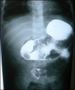 ajcr-2012-3-6 (1).JPG