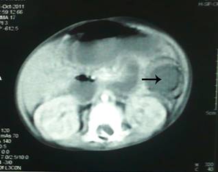 ajcr-2012-3-6 (2).JPG