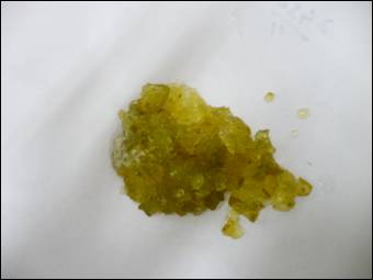 ajcr-2012-3-6 (3).JPG